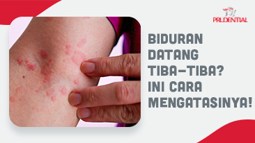 Apa Itu Biduran? Ketahui Gejala, Penyebab, dan Pencegahannya